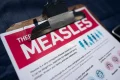 Measles outbreak in Virginia county grows to nearly 90 cases