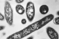 Third person dies amid NYC Legionnaires’ outbreak, officials say