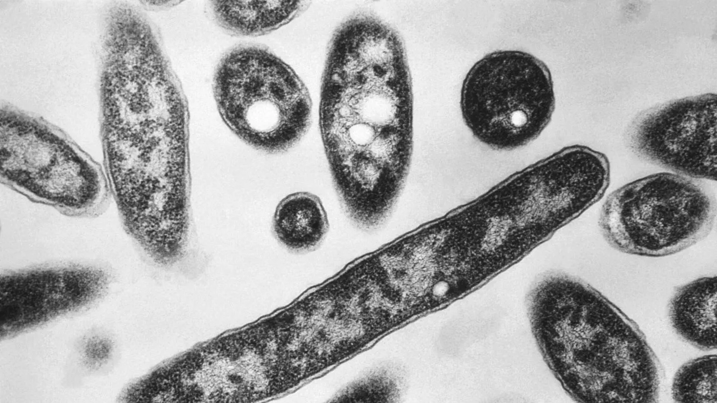 Third person dies amid NYC Legionnaires’ outbreak, officials say