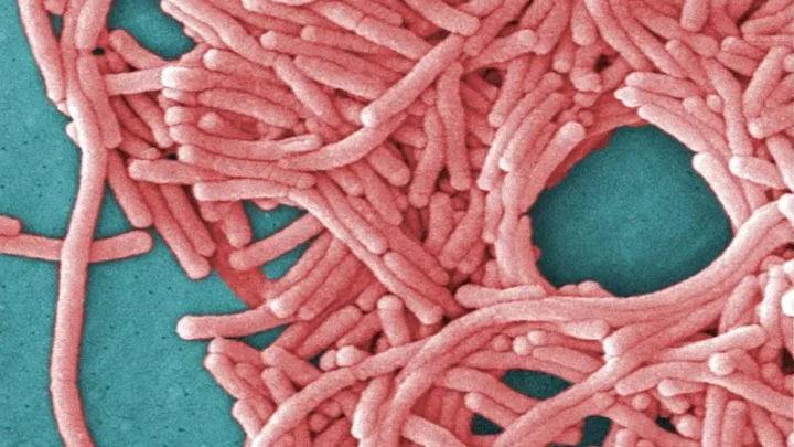 Fifth death reported in NYC Legionnaires’ outbreak