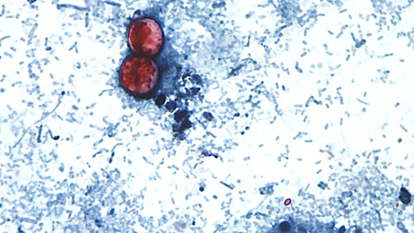 Cyclospora cases mounting in Michigan