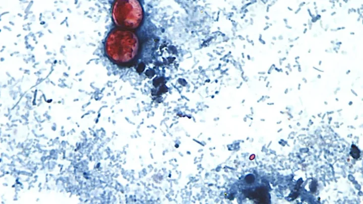 Cyclospora outbreaks with no confirmed sources grow: FDA