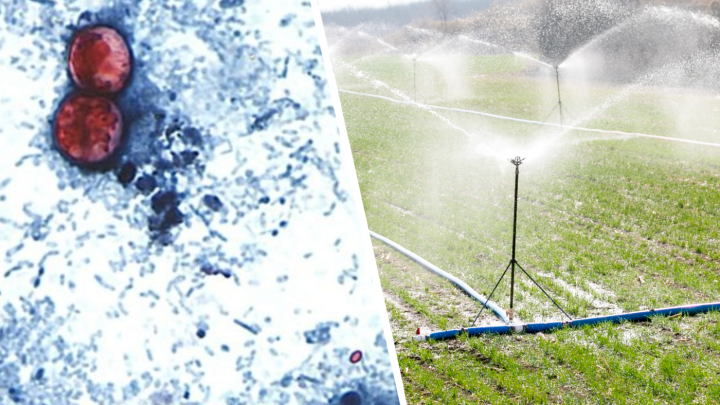 How many people actually have cyclosporiasis? Why it’s so hard to track
